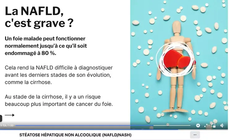 NAFLD, décrite par une vidéo du laboratoire Bio Medi Qual Centre